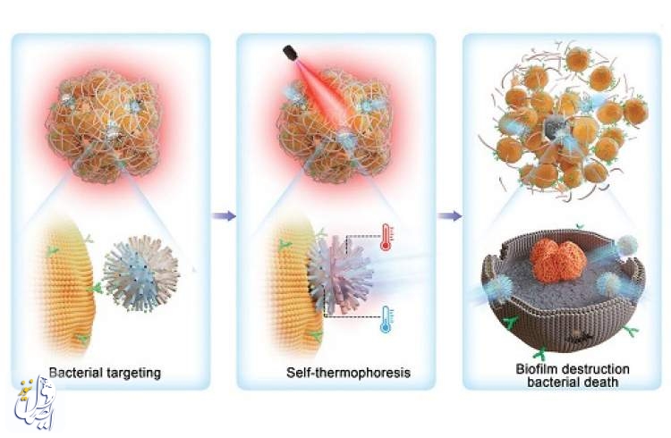 نابودی باکتری‌های کورکننده به دست نانو ربات‌ها